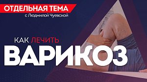 ОТС:Live | Как лечить варикоз? | Программа «Отдельная тема»