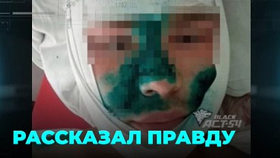 Изрезанный до полусмерти подросток рассказал о нападении сверстников