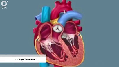 Рубрика "PRO здоровье": порок сердца